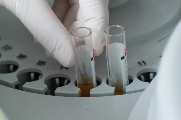 Kobieta ładowanie próbek w biochemicznych analizator — Zdjęcie stockowe