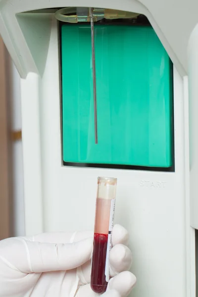 Vrouw performin hematologische test. — Stockfoto