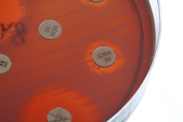 Bacteria on petri dish — Stock Photo, Image