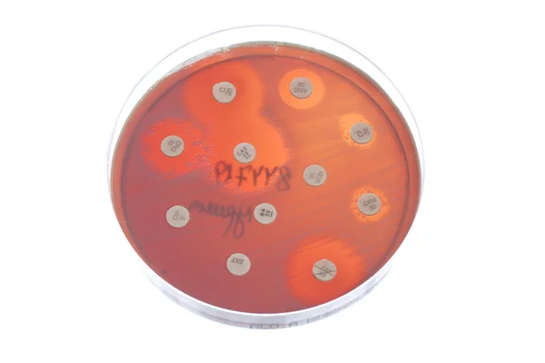 Bacteria on petri dish — Stock Photo, Image