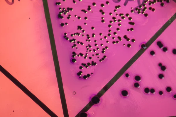 Bakterien auf Petrischale — Stockfoto