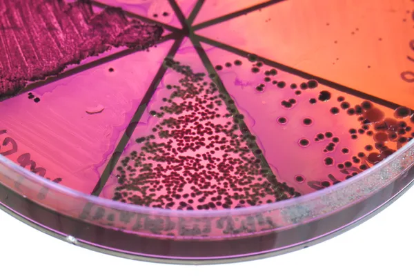 Bacteria on petri dish — Stock Photo, Image