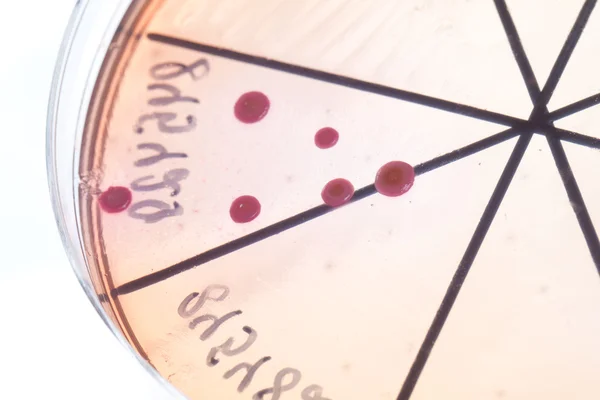 Bacteria on petri dish — Stock Photo, Image