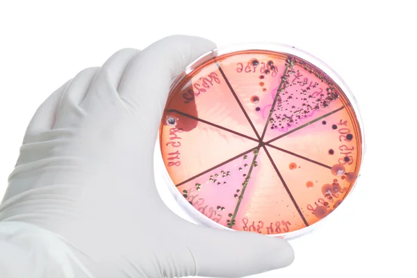 karanfil petri dish ile el