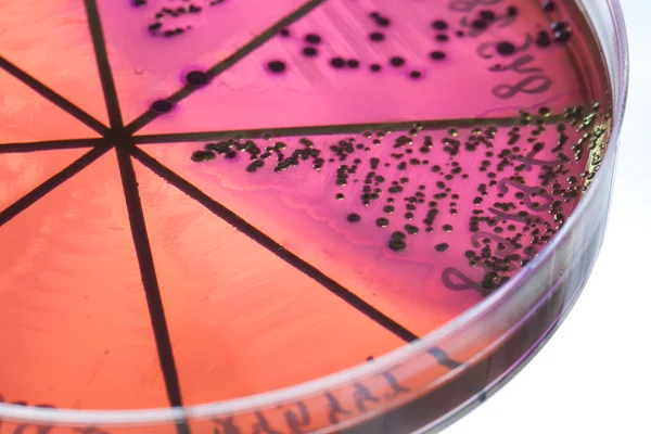 Бактерії на чашці Петрі — стокове фото