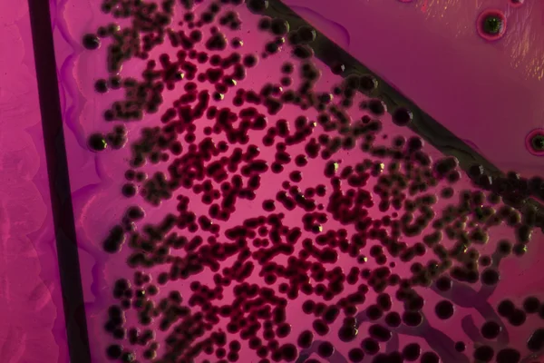 Βακτήρια σε τρυβλίο petri — Φωτογραφία Αρχείου