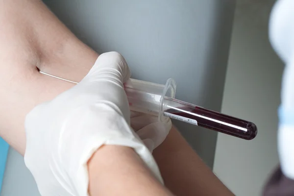 Procedimiento de extracción de sangre —  Fotos de Stock