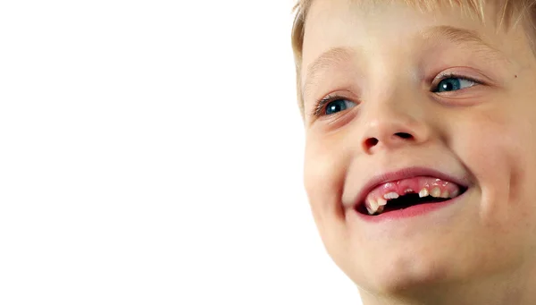 Bambino Con Denti Mancanti Sdentato Ragazzo Sorridente Copia Spazio — Foto Stock