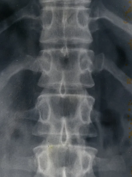 X-ray — Stock Photo, Image