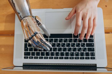 Kadın dizüstü bilgisayarda klavye yazmak için metal biyonik kol kullanıyor.