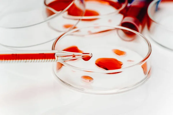혈액 코로나 바이러스 test.Virus 백신 발달 .Medical laboratory.Test tube, Petri dish with blood on the white background .Concept of lab research.blood test analysis with Petri dish close. — 스톡 사진