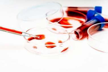 Tıbbi laboratuvar. Kan koronavirüsü testi. Virüs aşısı gelişiyor. COVID-19.Corona Virüsü laboratuvarda. Test tüpü ve kan örnekleri laboratuardaki masada, yakın plan. Virüs araştırması. Yakın plan..