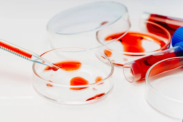 Blood coronavirus test.Virus vaccine development.Medical laboratory.Test tube,Petri dish with blood on a white background.Concept of laboratory research.Blood test analysis with Petri dish close up. — Fotografia de Stock