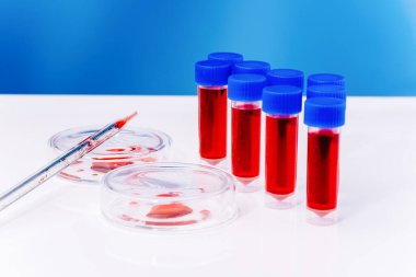 Tıbbi laboratuvar. Kan koronavirüsü testi. Virüs aşısı gelişiyor. COVID-19.Corona Virüsü laboratuvarda. Test tüpü ve kan örnekleri laboratuardaki masada, yakın plan. Virüs araştırması. Yakın plan..