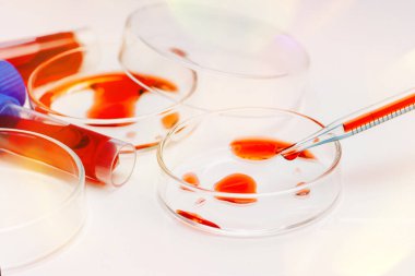 Coronavirus kan örneği COVID-19. Laboratuvarda kan dolu petri kabı ve test tüpleri var. Kan koronavirüsü testi. Virüs aşısı gelişimi. Pipette ve petri kabı..