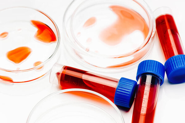 Чашка Петри и пробирки с кровью в лаборатории. Разработка вакцины против коронавируса крови. Медицинская лаборатория. Концепция лабораторных исследований. Крупный план. COVID-19. Корона в лабе.