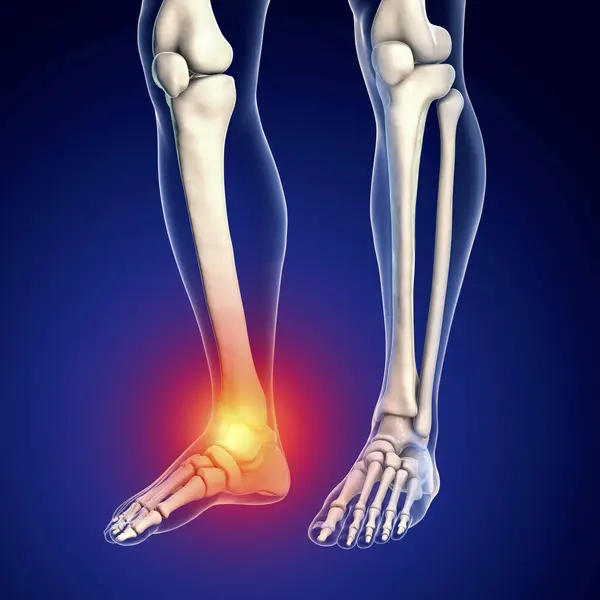 Painful Ankle Computer Illustration — Stock Photo, Image