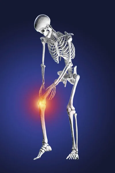 Menselijke Knie Pijn Computer Illustratie — Stockfoto