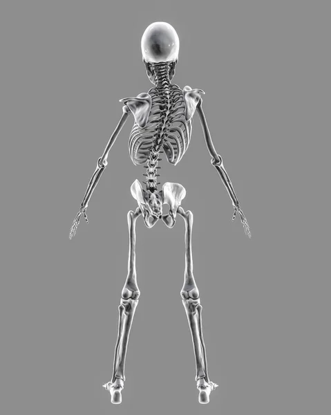 儿童结肠炎 计算机图解 儿童骨骼具有弯曲的脊椎 不均匀的肩膀和臀部的儿童骨骼 — 图库照片