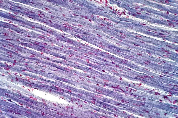 Muscolo Cardiaco Umano Micrografo Leggero Macchia Ematossilina Eosina — Foto Stock