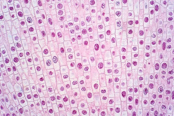 Light Micrograph Onion Allium Cepa Root Tip Cells Undergoing Mitosis — Stock Photo, Image