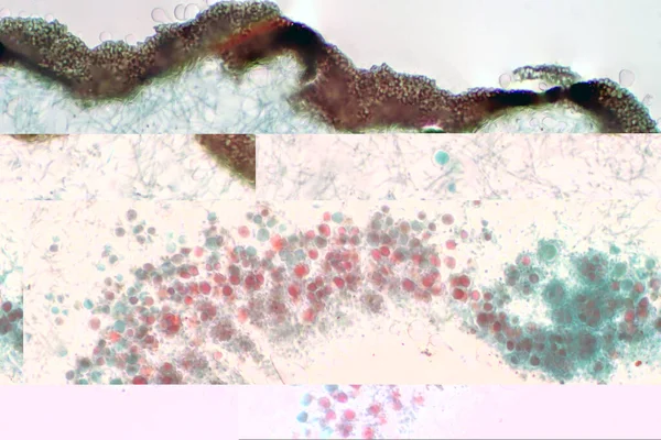 Lichtmikroskopie Zeigt Querschnitt Durch Flechten Und Pilze — Stockfoto