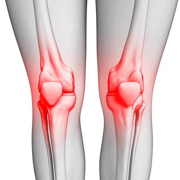 Dolor de rodilla humano ilustraciones — Foto de Stock