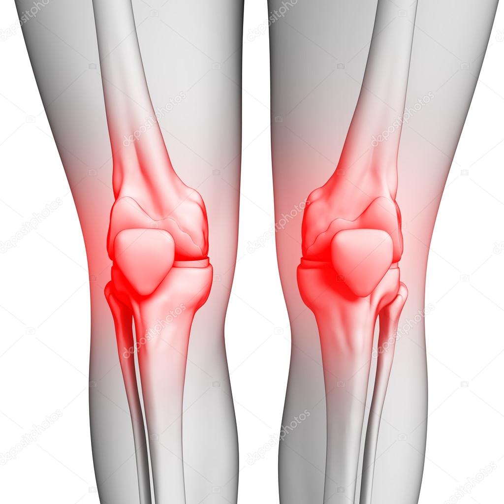 Human knee pain artwork