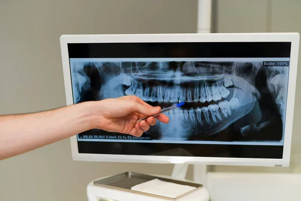 Medische Stomatologie Gezondheid Behandeling Professionele Tandheelkundige Kliniek — Stockfoto