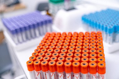 Steril kan testi konteynırı. Örnek laboratuvar bilimsel sağlık hizmetleri araştırması.