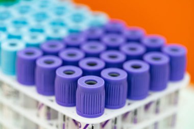 Laboratuvarda kan örneği toplamak için vakum tüpleri. Hastanedeki kan testleri için tıbbi laboratuvar. Masada cam tüpler var.