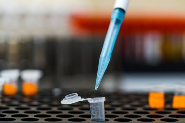 Laboratuvarda patojenlerin kültür bakterileri ve ilaç direnci üzerinde çalışan el sağlığı teknisyenleri için yakın plan; bakteri kültürü için bakteri tanımlama; manuel test