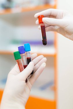 Elimizde kan örnekleri var. Biyoteknoloji analizi sağlık hizmetleri.