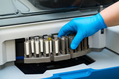 Laboratuvar test tüplerini inceliyor. Biyolojik örneklerin modern tıp araştırması.