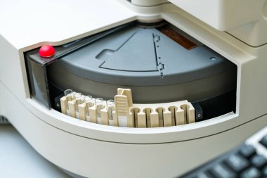 Modern laboratuarda Coronavirus test araştırması. Biyolojik tüp, Covid-19 hastalığının analizi ve örneklenmesi için..