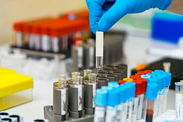 血液検査の医学分析 微生物学研究室設備 — ストック写真
