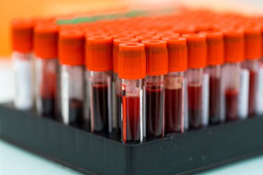 Bilimsel araştırma biyokimya örnekleri. Kimyasal deney laboratuvarı.