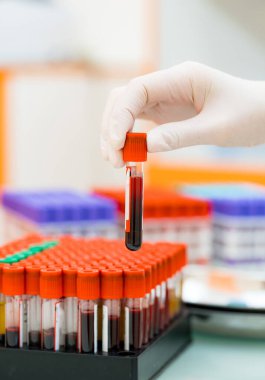 Kimyasal deney laboratuvarı. Bilimsel araştırma biyokimya örnekleri.