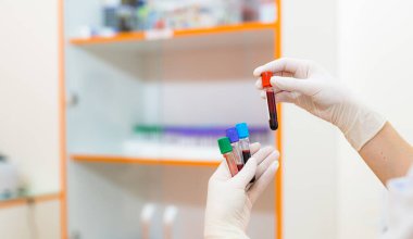 Kan tüpü ellerinde. Hematoloji laboratuvarında analiz için test. Hastalık teşhisi. Seçici odak