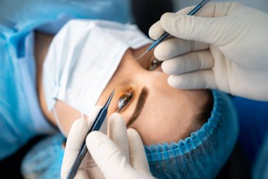 Modern görüş lazerle düzeltiliyor. Göz düzeltici lazer ekipmanı.