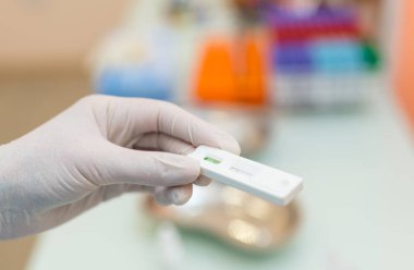 Corona test kanının yakın görüntüsü. Virüs testi analiz ediliyor.