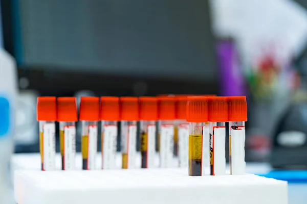 ウイルス解析実験の詳細を見る 病院研究室における科学的血液検査管 — ストック写真