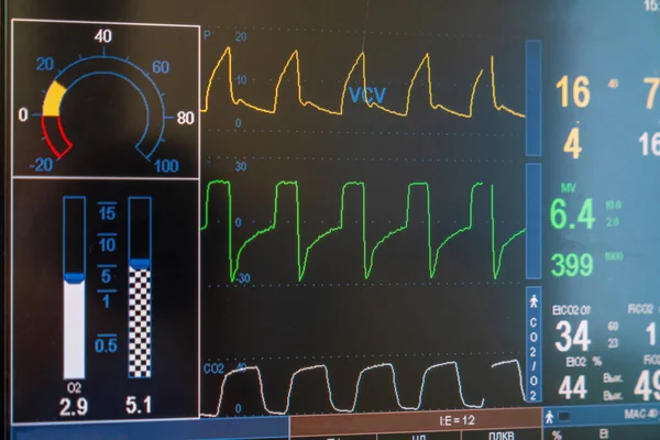 Recovery modern monitoring systems. Healthcare modern technologies.