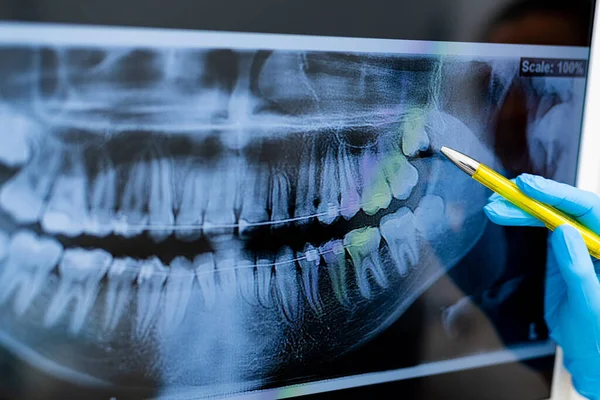 Diagnóstico Tecnologías Dentales Modernas Exámenes Rayos Dientes Profesionales — Foto de Stock