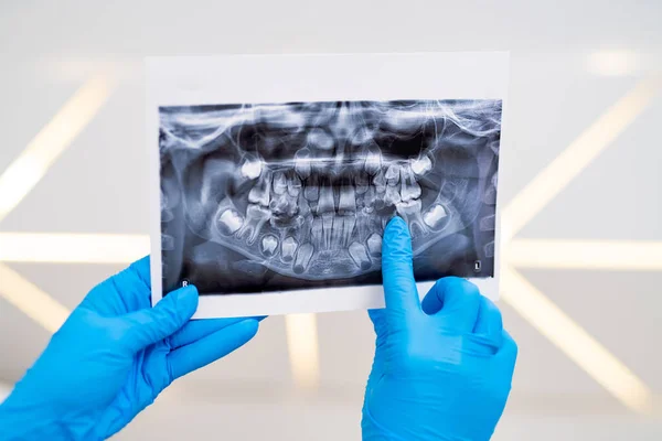 Tandheelkundige Röntgenfoto Resultaten Houden Handen Stomatologie Tanden Analyseren — Stockfoto