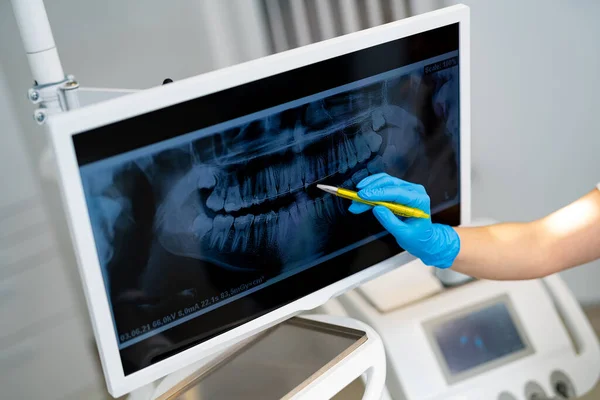 Modern Digital Radiology Stomatology Teeth Dentistry Ray Examination — Foto de Stock