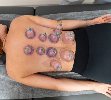 Professional relax pampering therapy. Vacuum massage close up view.