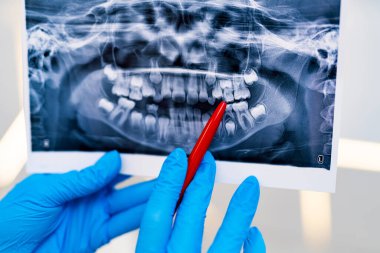 Röntgen dişçisi muayene ediyor. Radyografi Uzmanı Oral Hastane Teşhisi.