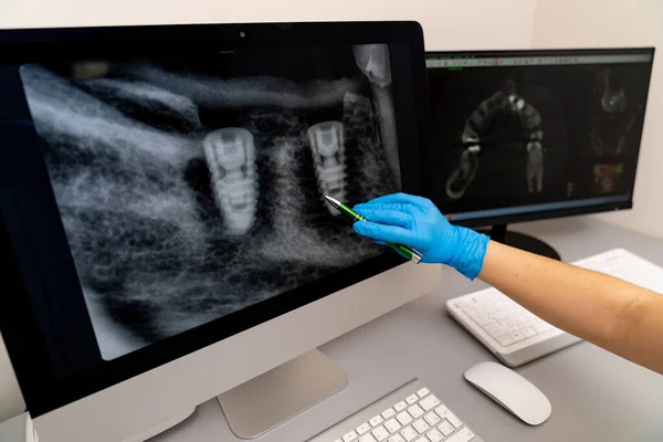 Radiology surgery implant technologies. X-ray professional oral healthcare examination.