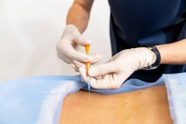 Sırt enjeksiyonu yakın çekim görüntüsü. Laboratuvar antibiyotik teşhisi için karantina.